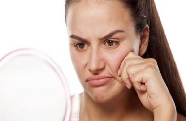 زوائد على الوجه تظهر أن مستويات الكوليسترول في الدم مرتفعة بشكل خطير