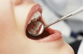  علامات صحية خفية يمكن معرفتها من خلال النظر إلى الأسنان