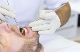 نصائح لحماية أسنان المدخن من نزيف اللثة