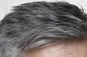 دور غير متوقع للشيب في مقاومة السرطان