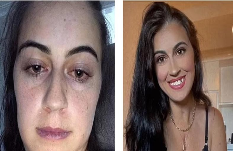 تخضع لـ 200 عملية بعدما ولدت بنصف قلب