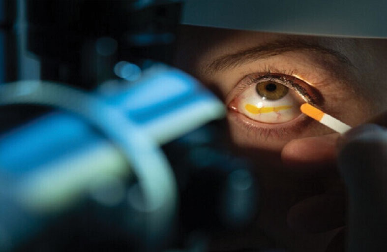 دراسة: فيروس يصيب الأسماك ينتقل إلى عيون البشر