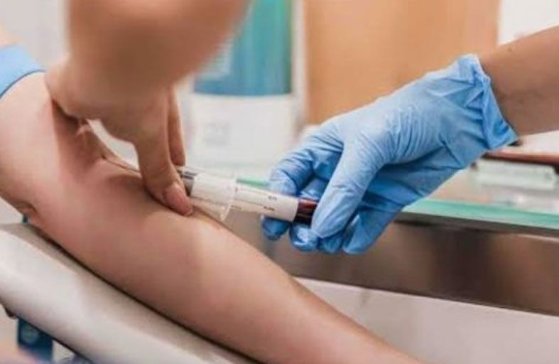 فحص يكشف سرطان المبيض في مراحله المبكرة 