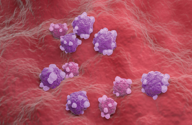 اكتشاف بروتين يساعد على تشخيص سرطان خطير يصيب النساء