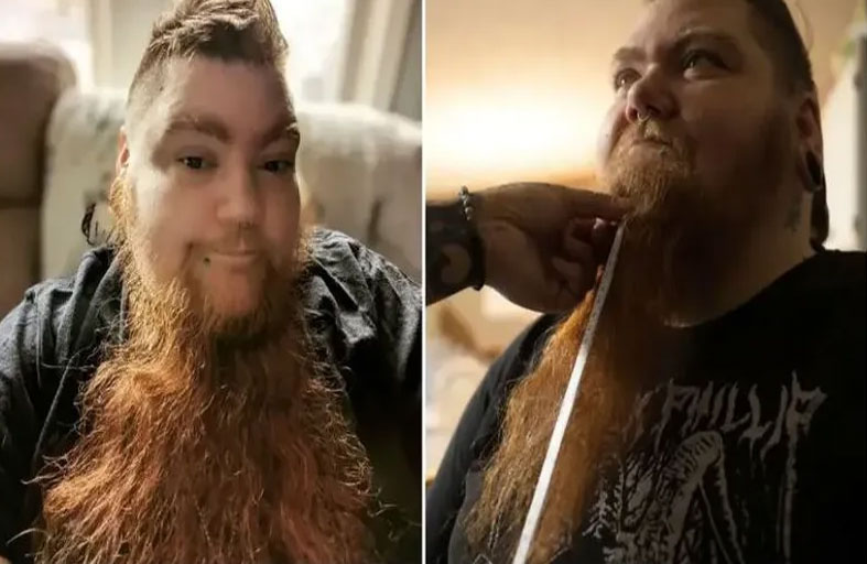 امرأة تحطم الرقم القياسي بأطول لحية في العالم