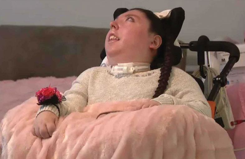 طفلة وُلدت بلا دماغ تحتفل بعيد ميلادها العشرين