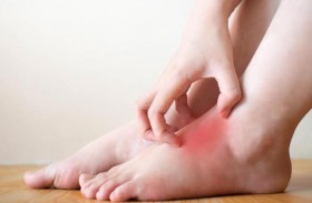 حكة الأقدام علامة على مشاكل صحية