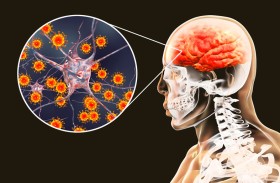 كيف ينتشر فيروس الحصبة في دماغ الإنسان ويتسبب في مرض قاتل؟