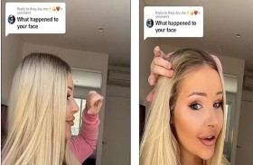 تتحول إلى باربي حقيقية بفضل عملية تجميل ناجحة