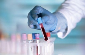 اختبار دم ثوري لتحديد عمر جهاز المناعة