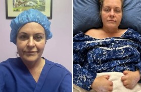 تخضع لـ 20 عملية بتر بسبب عملية تجميل