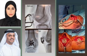 عملية معقدة لعلاج كسر في الركبة لأربعيني من أصحاب الهمم بمستشفى الفجيرة