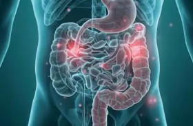 مشروب منزلي طبيعي ينظف القولون ويهدئ الأمعاء