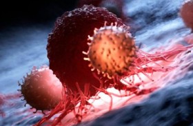 عادات يمكن أن تسبب السرطان