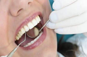 فقدان الأسنان قد يتنبأ بالتهاب المفاصل الروماتويدي