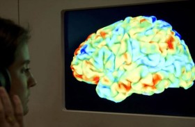 العلاج الصوتي غير الجراحي يعزز آمال مكافحة الزهايمر