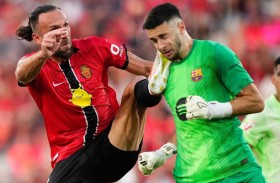 وجه متورم.. آثار التدخل العنيف تظهر على حارس برشلونة 