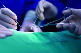 أب يتبرع بأعضاء ابنته ويستثني عينيها