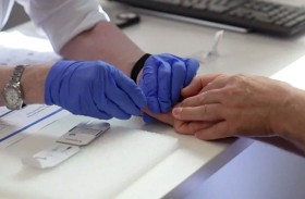 وخزة إصبع تغني عن فحوصات الدماغ لتشخيص الزهايمر