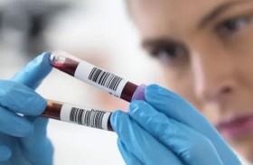 «تحليل دم» يكشف سرعة شيخوخة الجسم