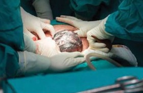 العراق.. قرار يمنع النساء من الولادة في «تواريخ مميزة»