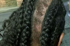 عاملات مطعم ينتزعن شعر زبونة