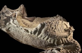 أدلة على معاناة القدماء من الطفيليات والعدوى قبل 1300 عام