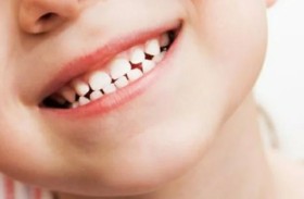 أمراض الفم في الطفولة قد ترتبط بحالة صحية قاتلة في البلوغ