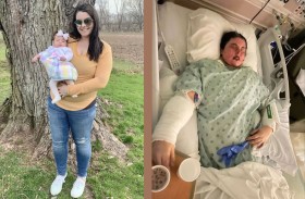 دواء شائع يحرق جسد امرأة ويصيبها بالعمى