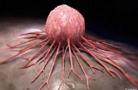 تقنية جديدة تنجح في قتل الخلايا السرطانية