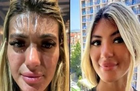جبين شابة يتحول إلى قطعة بلاستيك