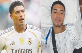 ريال يستعيد بيلينغهام وكاريراس إضافة إلى مبابي 