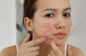 خبيرة تجميل توثق فاعلية مكمل يعيد لبشرتك إشراقها