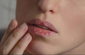 جفاف الفم.. علامة حمراء على 5 أمراض خطيرة