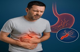 علاجات طبيعية لجرثومة المعدة.. احرص على هذه الأكلات لتخفيف الأعراض
