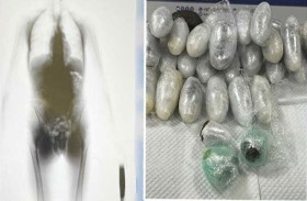 ضبط حشيش داخل أمعاء مسافر 