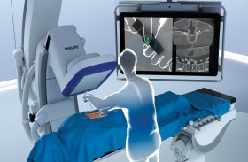 فيليبس تطلق ClarifEye للتوجيه الجراحي المكاني بتقنية الواقع المعزز للحد الأدنى من التدخل الجراحي