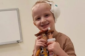 هجوم كلبين يشوّه طفلاً ويفقده أذنه 