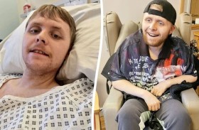 رحيل أصغر ضحايا الخرف.. بعمر 24 عاماً 