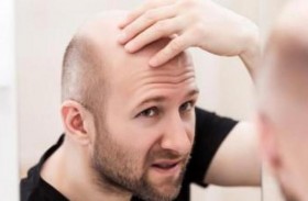 دواء يداوي مشكلتين لدى الرجال.. أشهرها تساقط الشعر