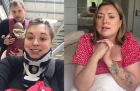 تثاؤب يؤدي لكسر فقرات امرأة 