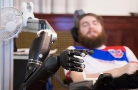 ذراع روبوتية حساسة للمصابين بالشلل