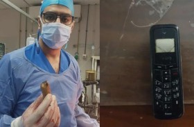 قصص غريبة لمرضى عاشوا شهوراً بهواتف داخل أحشائهم