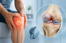 خبراء يطورون حبيبات تساهم في ترميم العظام