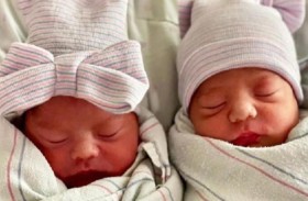 ولادة توأم في عامين مختلفين