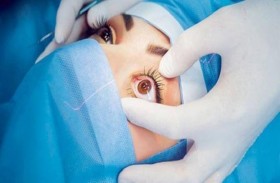 علاج ثوري في طب العيون يُغني عن زراعة القرنية