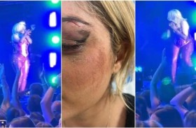 3 غرز بالوجه.. ماذا حدث للمغنية الأمريكية «بيبي ريسكا»؟