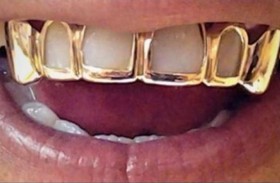 ممرض يسرق سن ذهب من فم متوفى