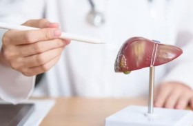علماء يطوّرون علاجاً يُوقف تليف الكبد أو يعكس مساره