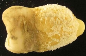 سنّ مومياء بوليفية تعيد كتابة تاريخ الحمى القرمزية